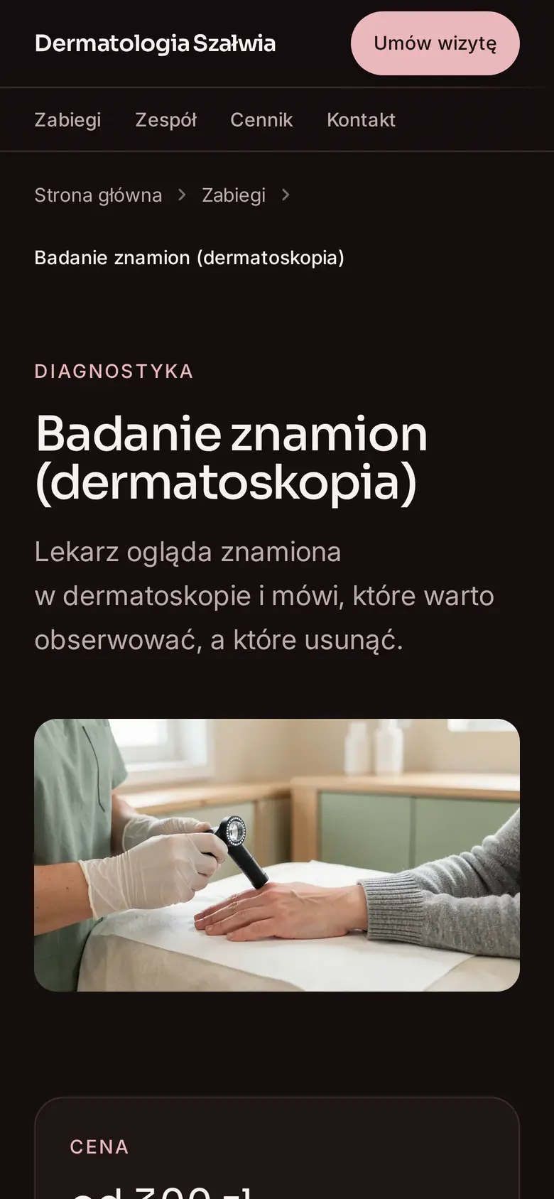 Strona zabiegu Badanie znamion (dermatoskopia) w przykładowej placówce Dermatologia Szałwia na telefonie: opis, cena „od”, czas trwania i przycisk rezerwacji